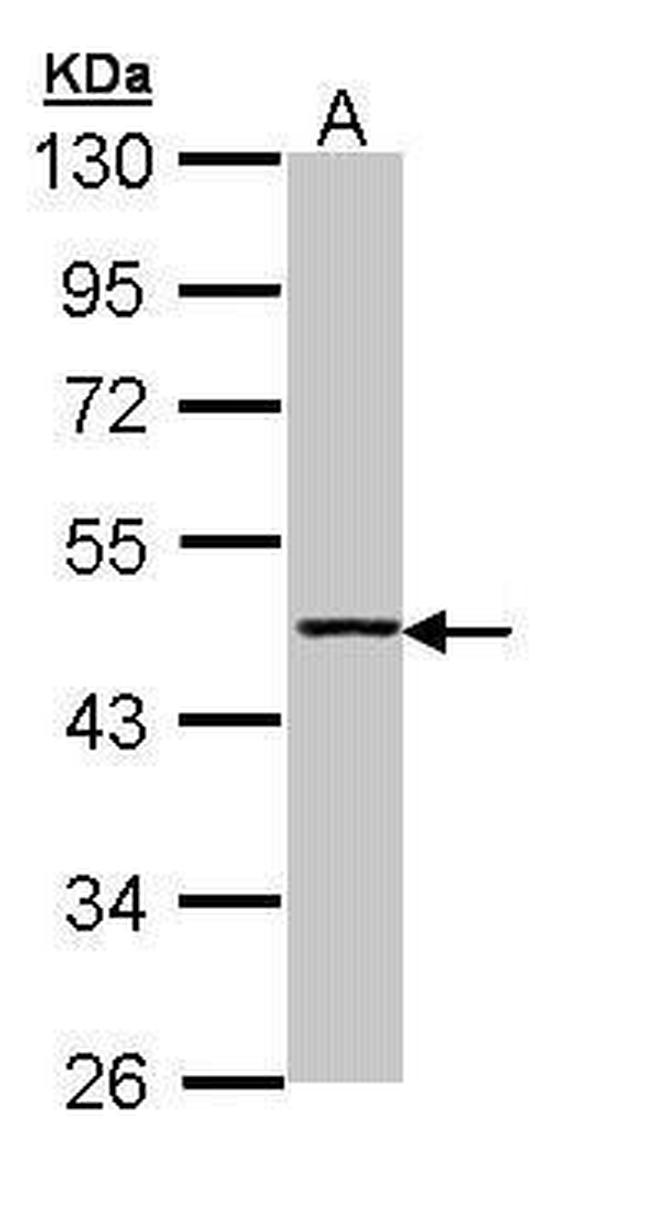 Aminoacylase Antibody in Western Blot (WB)