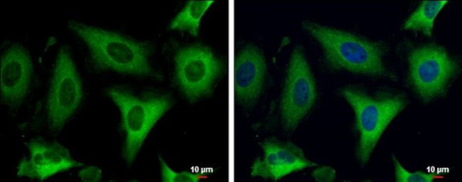 FASN Antibody in Immunocytochemistry (ICC/IF)