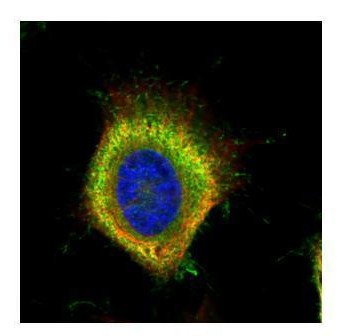 FASN Antibody in Immunocytochemistry (ICC/IF)