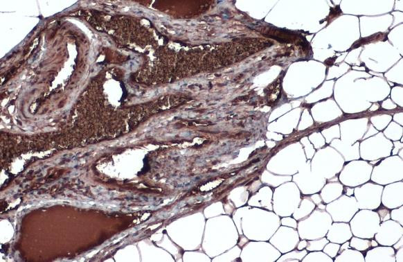 FASN Antibody in Immunohistochemistry (Paraffin) (IHC (P))