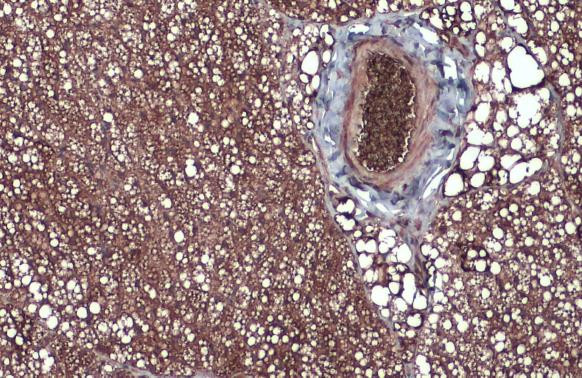 FASN Antibody in Immunohistochemistry (Paraffin) (IHC (P))