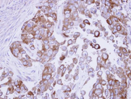 FASN Antibody in Immunohistochemistry (Paraffin) (IHC (P))