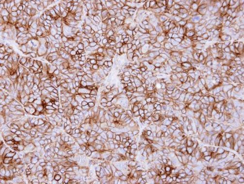 KIDINS220 Antibody in Immunohistochemistry (Paraffin) (IHC (P))