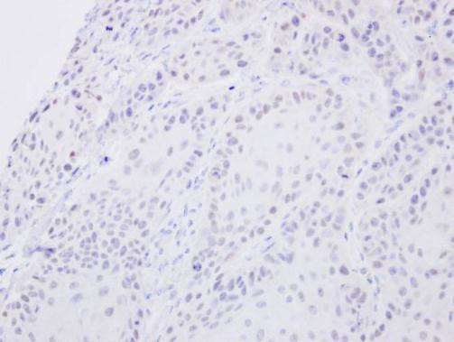 SENP2 Antibody in Immunohistochemistry (Paraffin) (IHC (P))