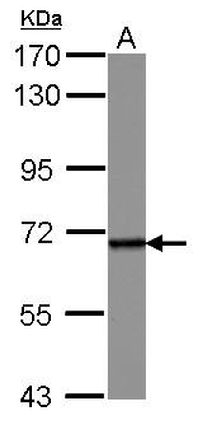 SENP2 Antibody in Western Blot (WB)