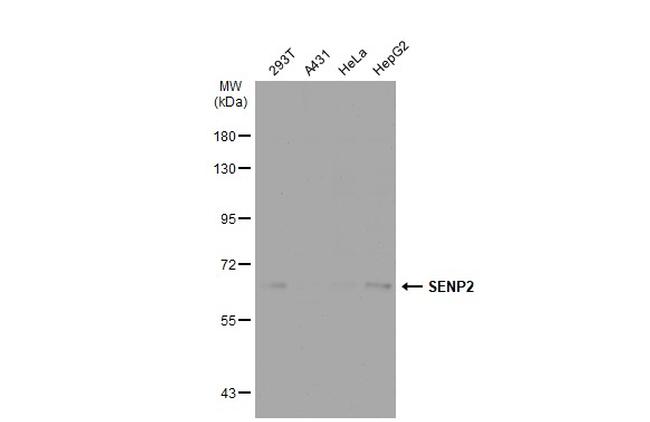 SENP2 Antibody in Western Blot (WB)