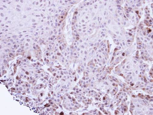 TACC2 Antibody in Immunohistochemistry (Paraffin) (IHC (P))