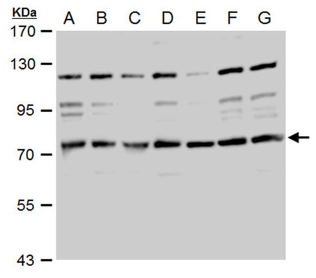 TACC2 Antibody in Western Blot (WB)