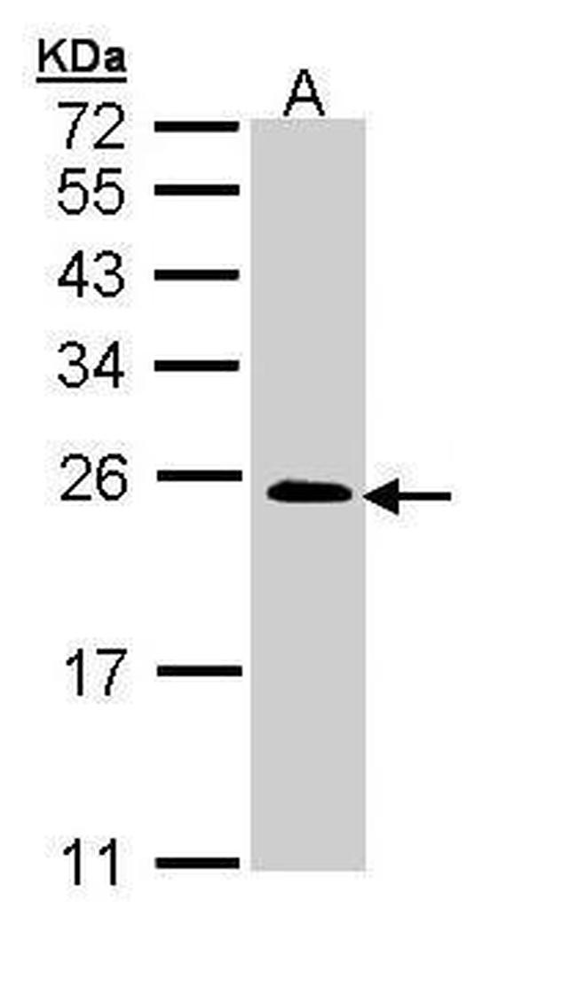 RRAS2 Antibody in Western Blot (WB)