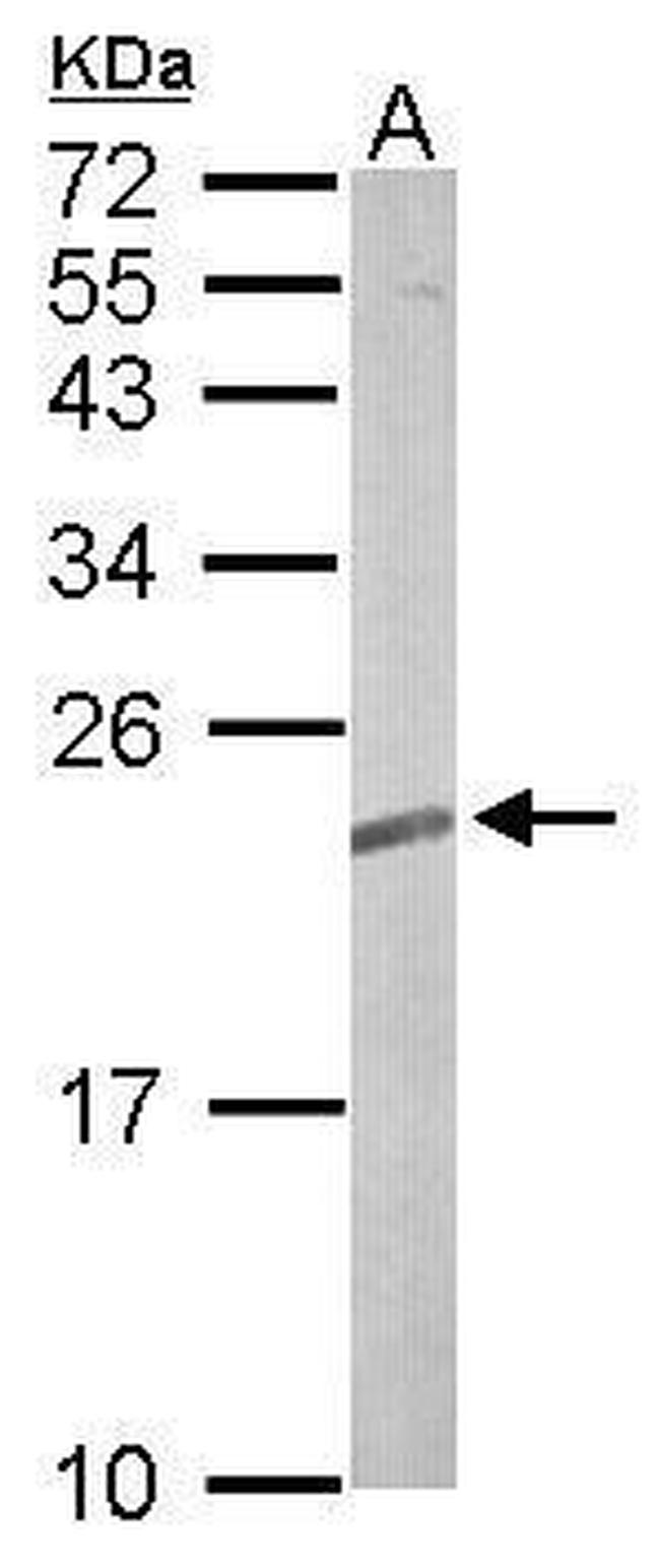 RRAS2 Antibody in Western Blot (WB)