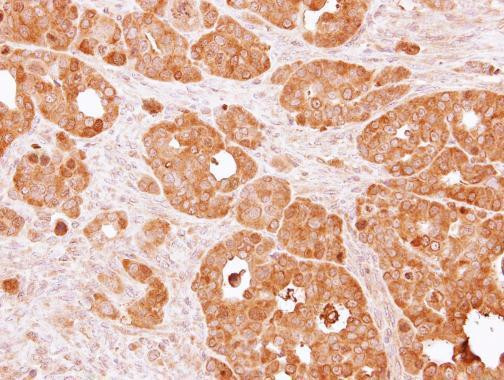 PSAT1 Antibody in Immunohistochemistry (Paraffin) (IHC (P))