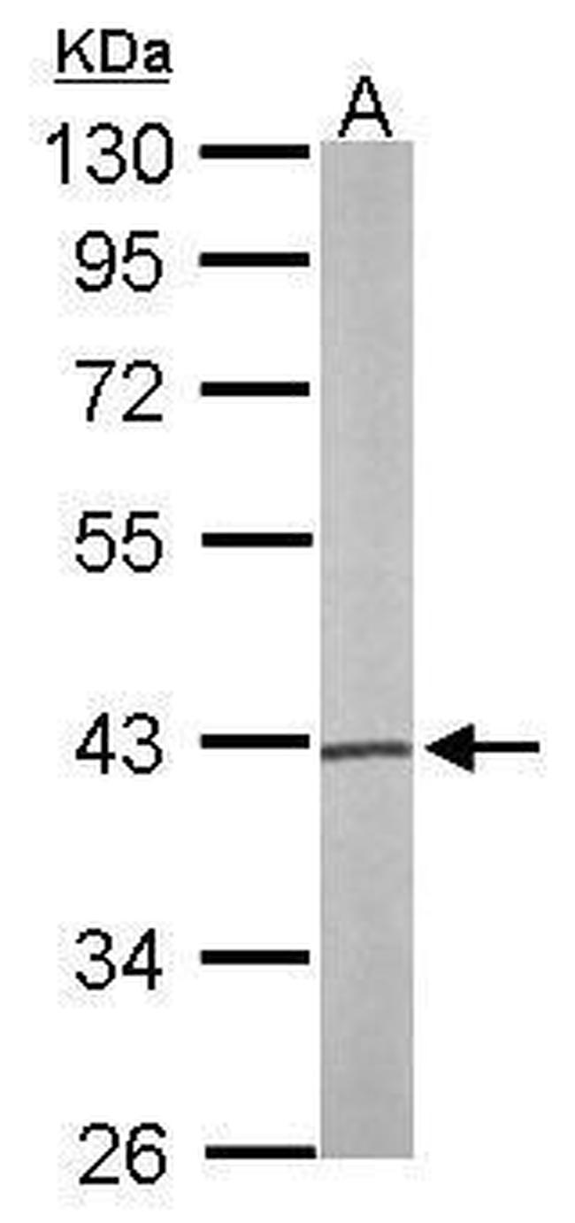 PSAT1 Antibody in Western Blot (WB)