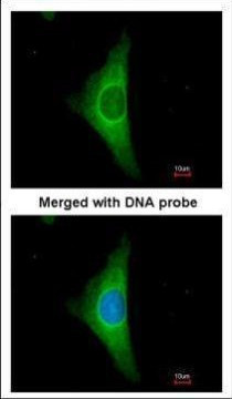 Cytokeratin 20 Antibody in Immunocytochemistry (ICC/IF)