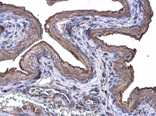 Cytokeratin 20 Antibody in Immunohistochemistry (Paraffin) (IHC (P))