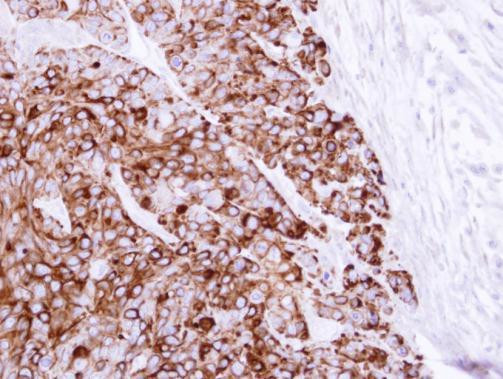 Cytokeratin 20 Antibody in Immunohistochemistry (Paraffin) (IHC (P))