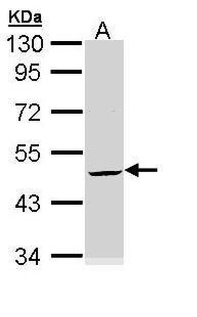 Cytokeratin 20 Antibody in Western Blot (WB)