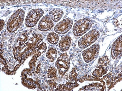 Citrate Synthase Antibody in Immunohistochemistry (Paraffin) (IHC (P))