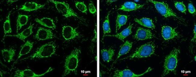 Citrate Synthase Antibody in Immunocytochemistry (ICC/IF)