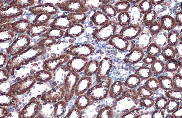 Citrate Synthase Antibody in Immunohistochemistry (Paraffin) (IHC (P))