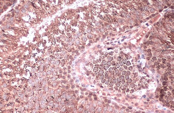 Citrate Synthase Antibody in Immunohistochemistry (Paraffin) (IHC (P))