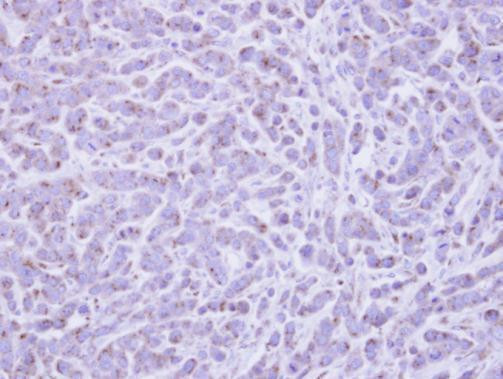 RAB6A Antibody in Immunohistochemistry (Paraffin) (IHC (P))