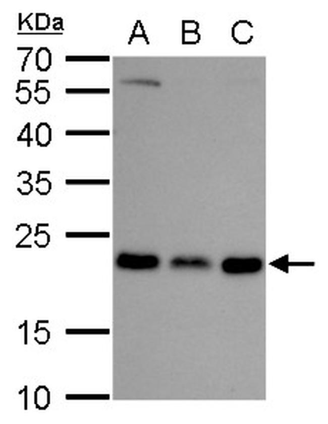 RAB6A Antibody in Western Blot (WB)