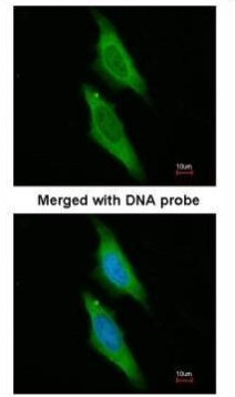 AIP Antibody in Immunocytochemistry (ICC/IF)