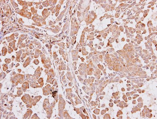 AIP Antibody in Immunohistochemistry (Paraffin) (IHC (P))