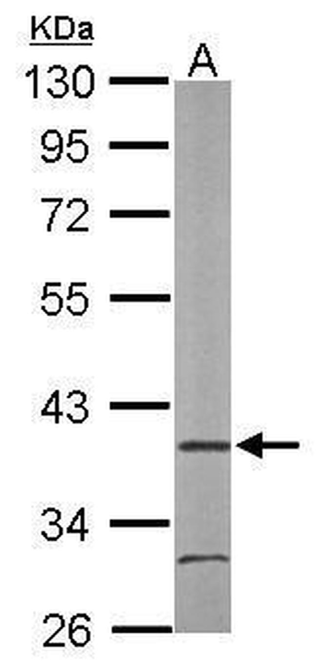 AIP Antibody in Western Blot (WB)