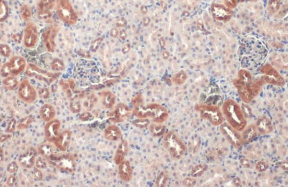 V-ATPase H Antibody in Immunohistochemistry (Paraffin) (IHC (P))