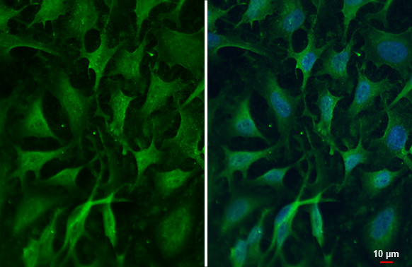 ZC3H12A Antibody in Immunocytochemistry (ICC/IF)