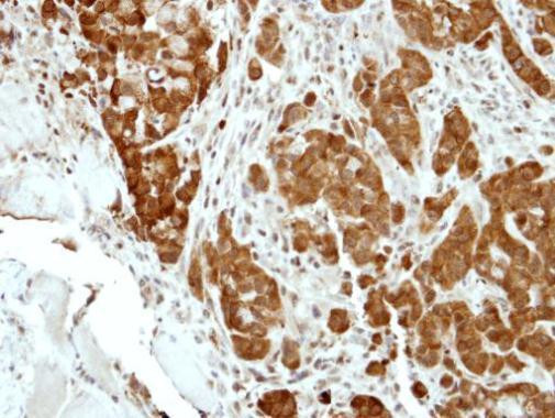 BCL2L15 Antibody in Immunohistochemistry (Paraffin) (IHC (P))