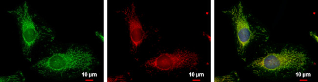 FIS1 Antibody in Immunocytochemistry (ICC/IF)