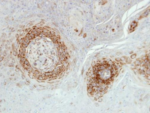 NDUFA5 Antibody in Immunohistochemistry (Paraffin) (IHC (P))