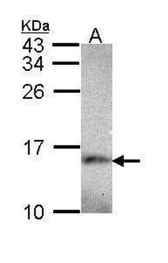 NDUFA5 Antibody in Western Blot (WB)