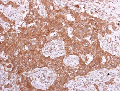 PPA1 Antibody in Immunohistochemistry (Paraffin) (IHC (P))