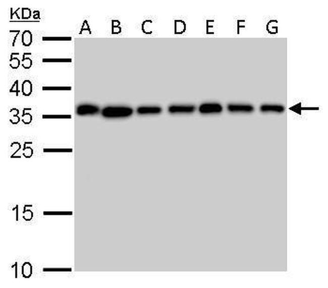 PPA1 Antibody in Western Blot (WB)