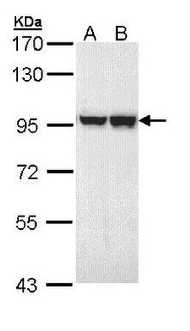 MALT1 Antibody in Western Blot (WB)