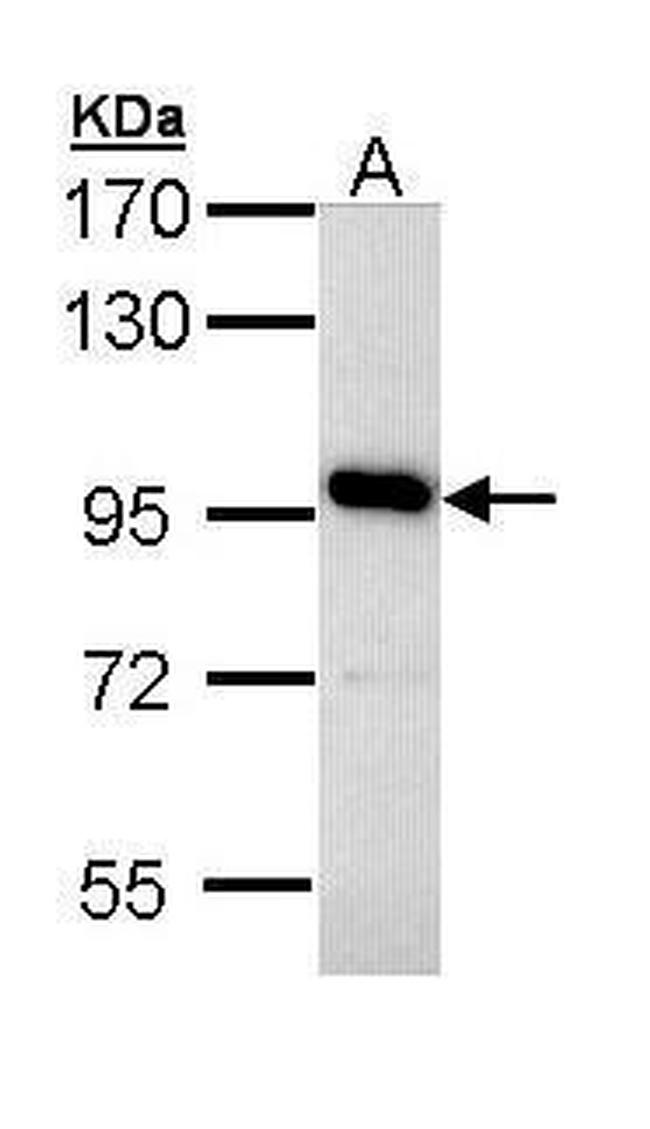 ATP6V0A4 Antibody in Western Blot (WB)