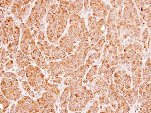 UNC13B Antibody in Immunohistochemistry (Paraffin) (IHC (P))