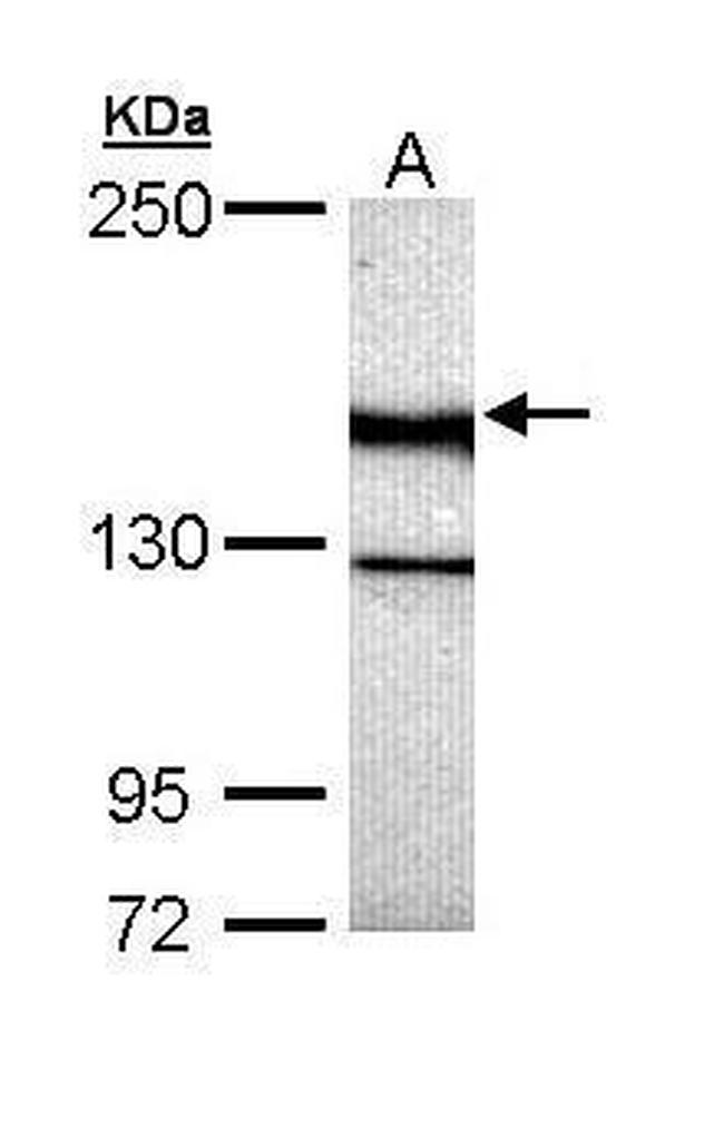 UNC13B Antibody in Western Blot (WB)