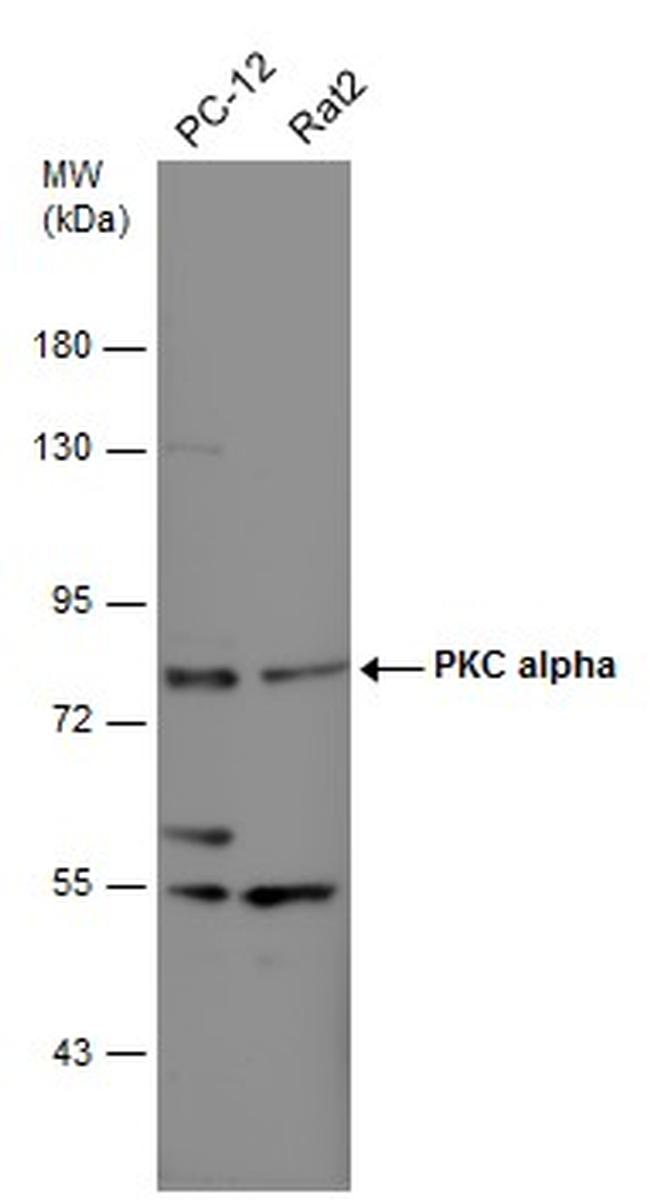 PKC alpha Antibody in Western Blot (WB)