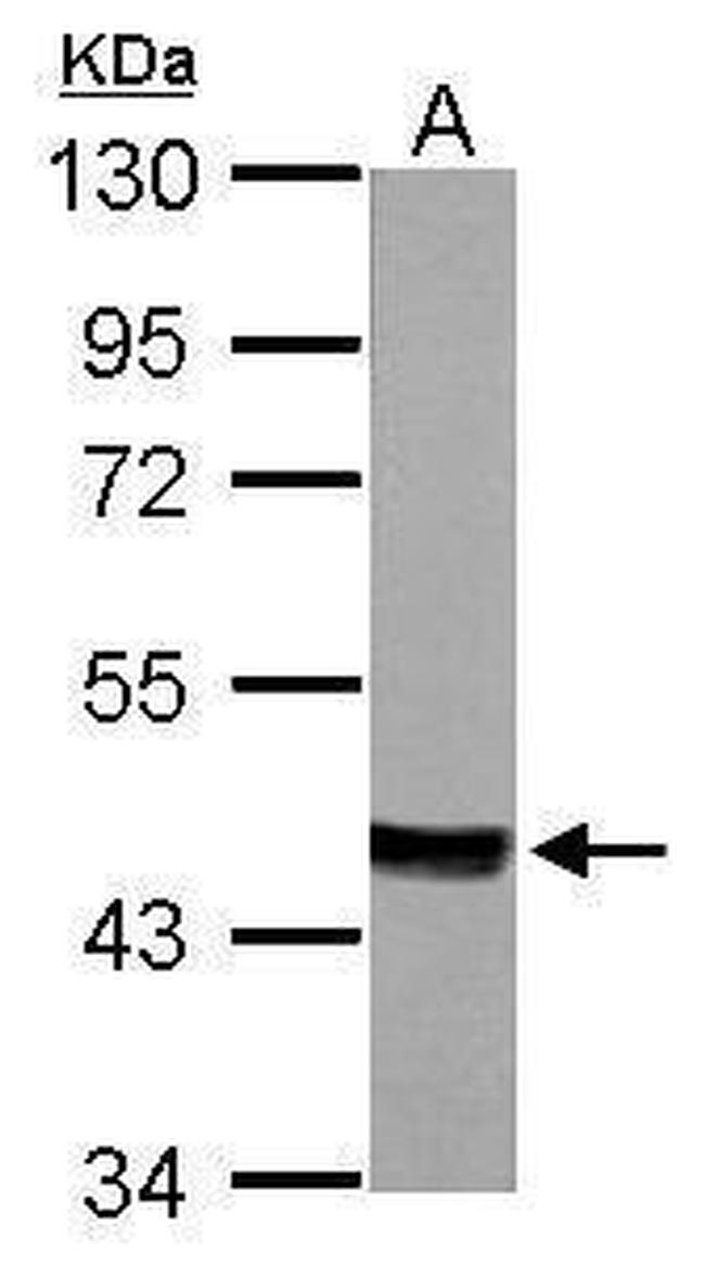 MVD Antibody in Western Blot (WB)