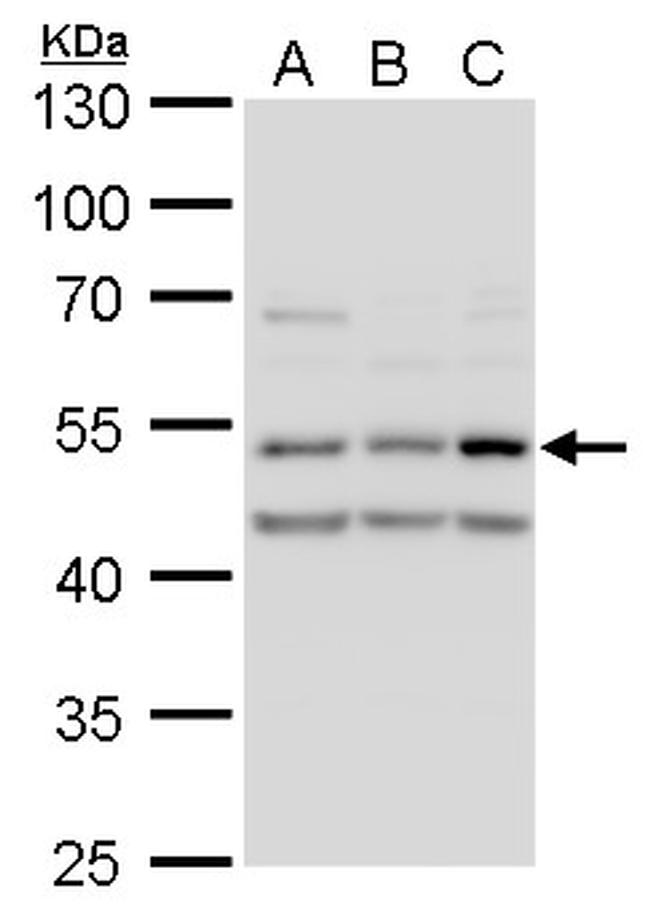 CaMKII delta Antibody in Western Blot (WB)