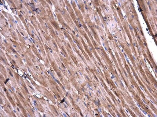 CaMKII delta Antibody in Immunohistochemistry (Paraffin) (IHC (P))