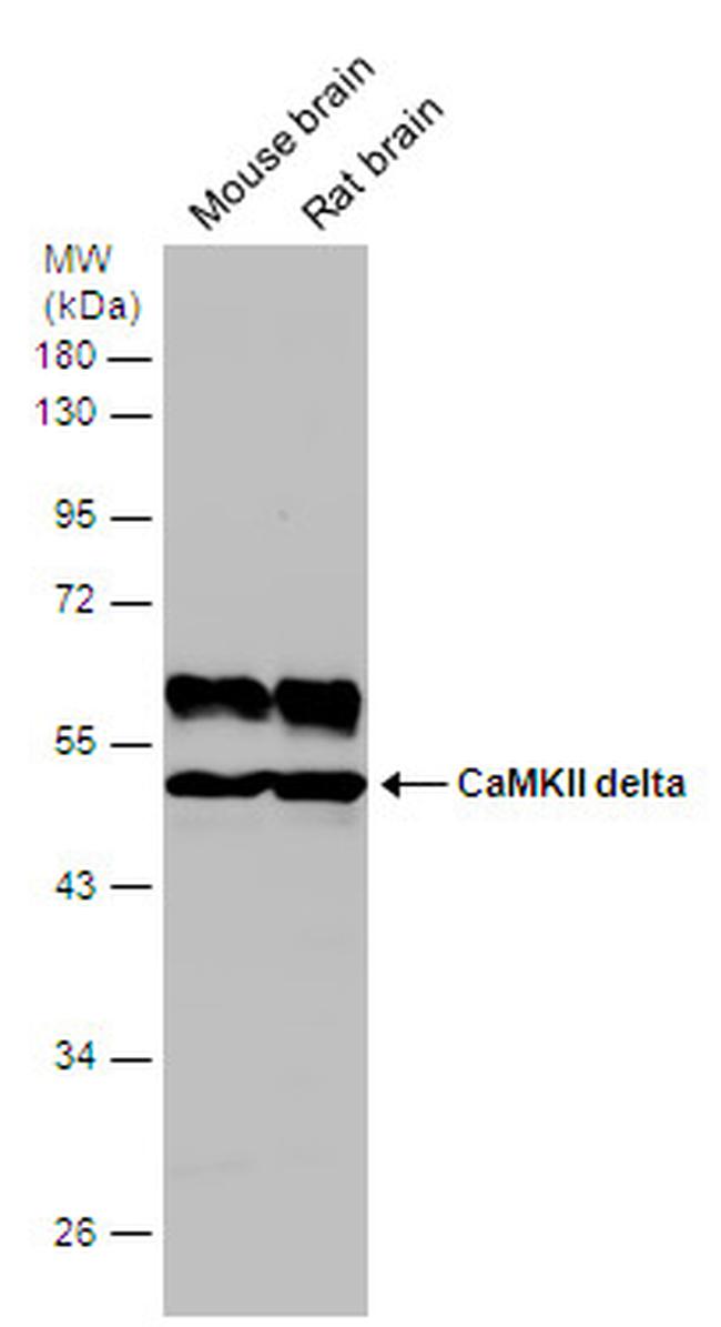 CaMKII delta Antibody in Western Blot (WB)