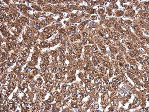 MVD Antibody in Immunohistochemistry (Paraffin) (IHC (P))