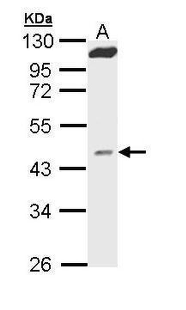 MVD Antibody in Western Blot (WB)