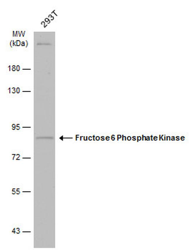 PFKM Antibody in Western Blot (WB)