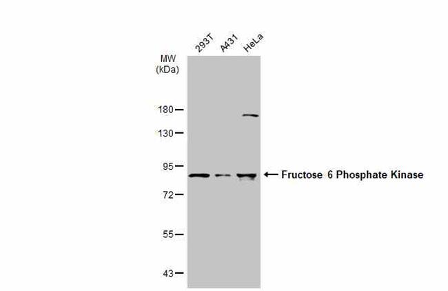 PFKM Antibody in Western Blot (WB)